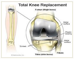 Slider image (5) Sahara Medical 